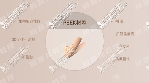 peek修复下颌角危险么？peek材料移植下颌骨多少钱？