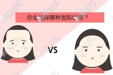 你会选择哪种发际线？