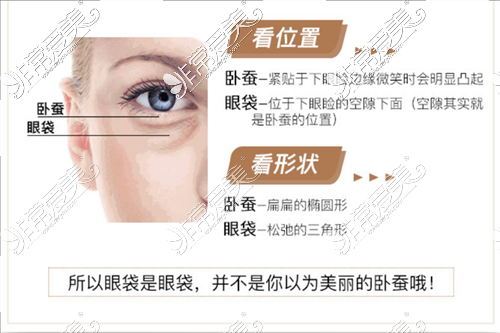 眼袋、臥蠶區(qū)分示意圖