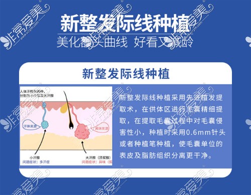 乌鲁木齐市植发哪里好？汇总乌鲁木齐市好的植发医院！