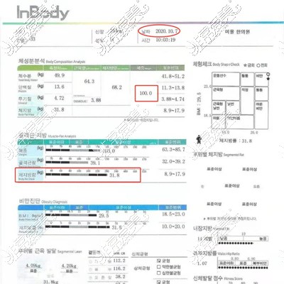 服用韩国美尔韩方医院减肥丸一个月体重体脂数据图