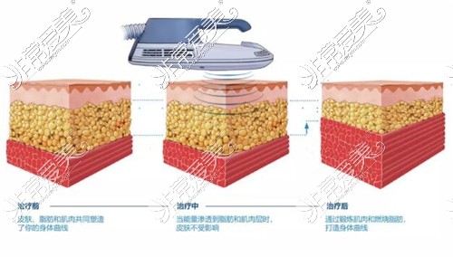 美修斯仪器操作过程图