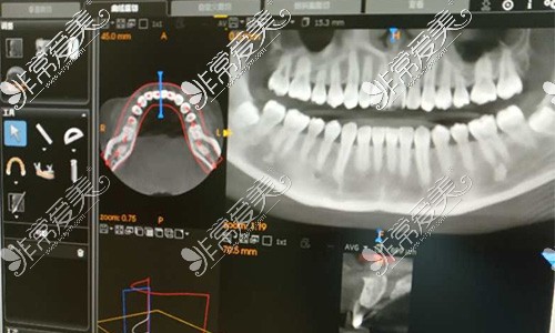 数字化建模