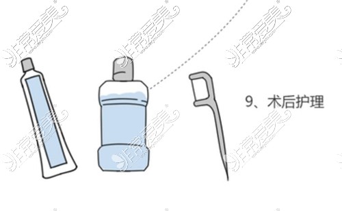 种植牙术后护理