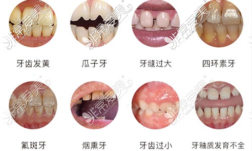 牙齿修复适应症