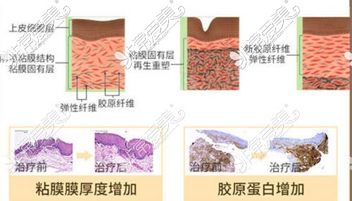 深圳缩阴手术哪家医院好？曝光阴道紧缩真实价格是多少！