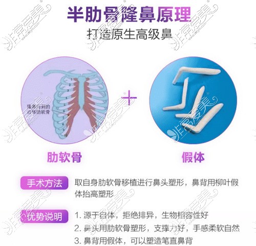 汕头整形医院隆鼻哪好?汕头膨体硅胶肋骨隆鼻哪种手术好?