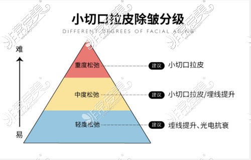 拉皮手術(shù)效果示意圖