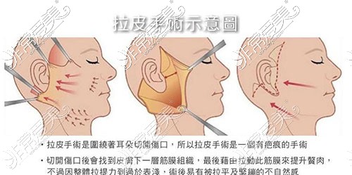 大连面部除皱整形哪家好?推荐热玛吉拉皮除皱比较好的医院