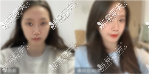 常州美贝尔整形医院医生哪个好？听说院长技术口碑就不错