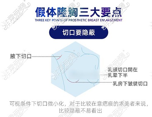 上海哪家医院隆胸技术好，丰胸靠谱效果佳都在这五家！