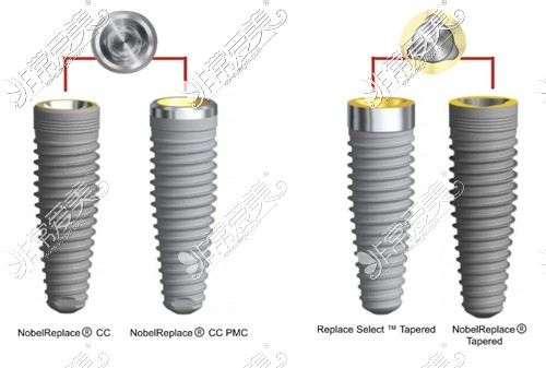 诺贝尔种植牙型号对比