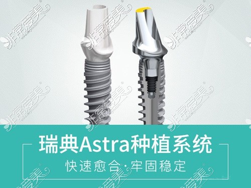 瑞典astra种植体型号及规格汇总，瑞典astra种植牙寿命揭秘！