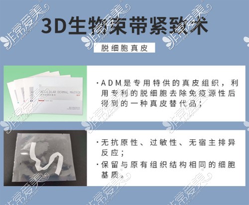 3d生物束带紧缩术收费公布，揭秘生物束带紧缩术多少钱！