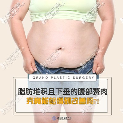 韩国高兰得整形外科腹部吸脂