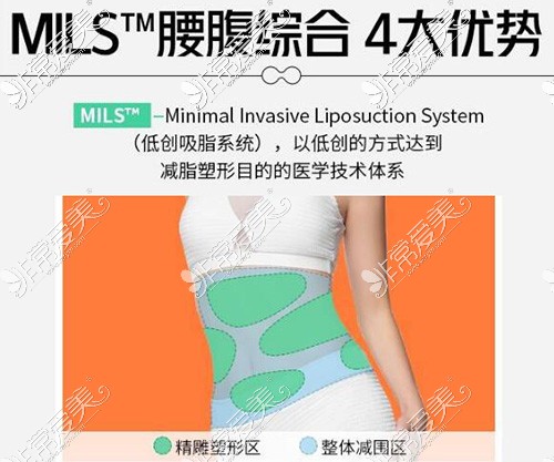 MILS吸脂腰腹综合优势