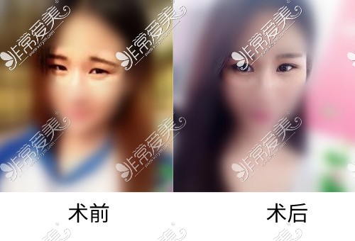 襄阳韩寇整形医院怎么样?公布网友评价及特色项目收费价格