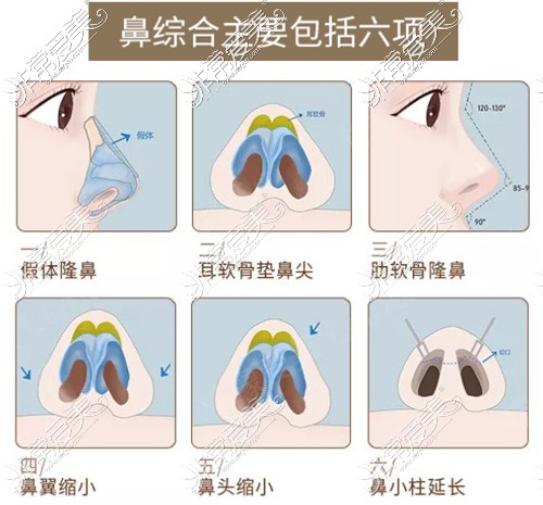 鼻综合手术项目展示