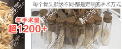 重庆磨骨问题合集!从医院推荐+医生+价格+案例一网打尽！