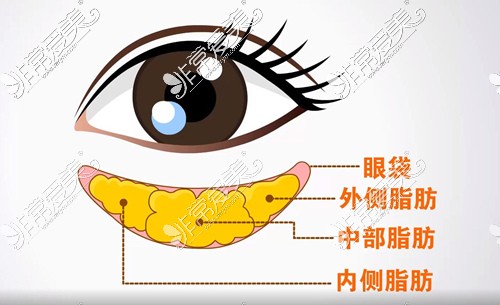 眼部脂肪分布情况