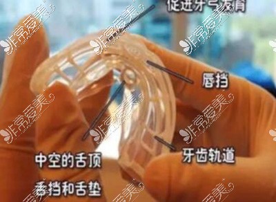儿童早期干预矫正器照片