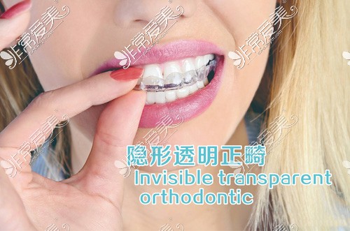 隐形矫正宣传图