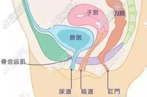 盆底肌松弛引起漏尿