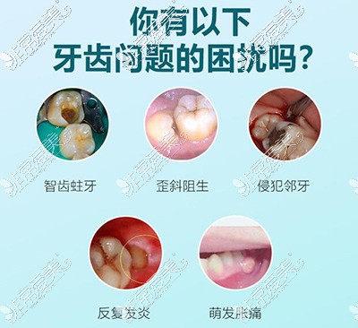 长沙拔智齿要花多少钱一颗,在长沙拔智齿可以医保报销吗?