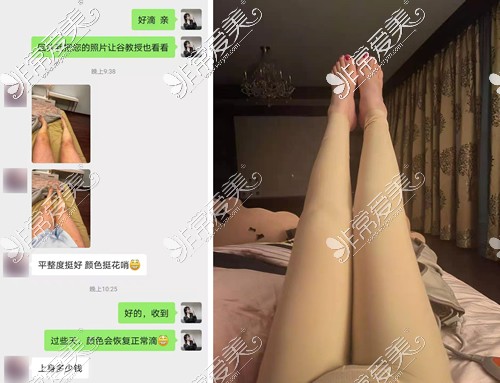 北京达美如艺吸脂修复术后反馈图