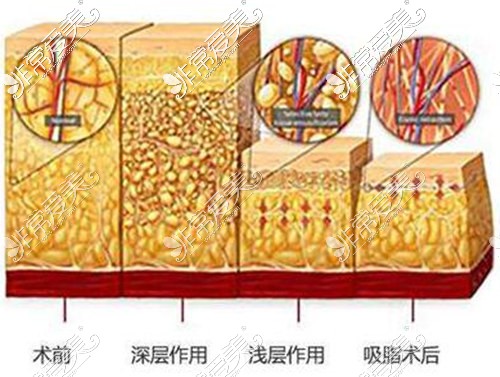 宜春天泽美容医院正规吗？医院优势及三大项目分享！