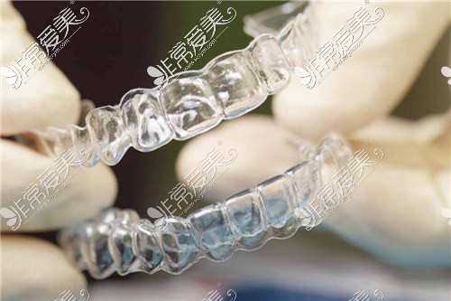 隐形矫正牙套