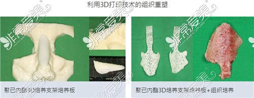 韩国H白汀桓整形外科3D打印技术