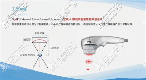 7d聚拉提效果维持多久？分析7d聚拉提和热玛吉哪个好！