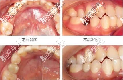 湖州維佳康口腔種植牙<span style=