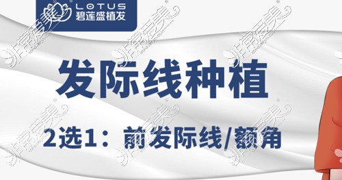 苏州发际线种植医院推荐!分享当地发际线调整哪里好?