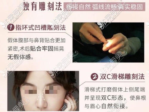 南宁爱思特隆鼻怎么样？南宁做隆鼻术好的医院排行名单