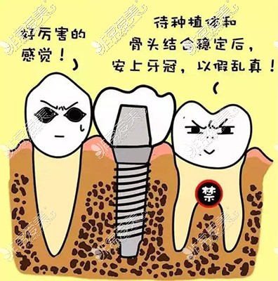 种植牙漫画
