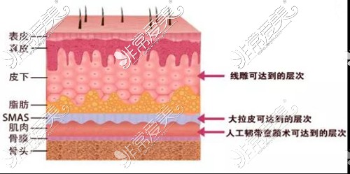 7D聚拉提做完多久有作用?和欧洲之星有什么区别?