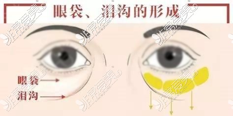 为什么女人衰老这么快？盘点面部衰老原因及抗衰老医美