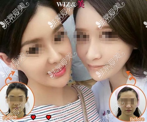 韩国WIZ&美整形外科整形美肤案例