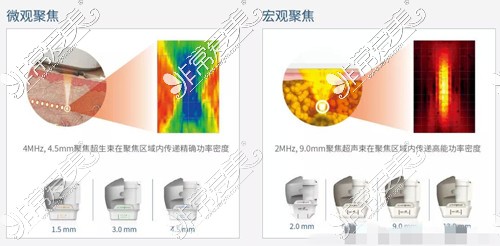 7d聚拉提微观聚焦和宏观聚焦技术