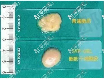 脂肪膠對比普通脂肪形態(tài)