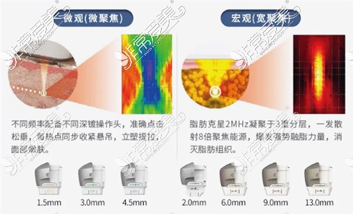 7d聚拉提副作用,后遗症,禁忌人群,做完后注意事项,功效科普!