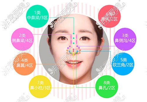 惠州瑞芙臣整形假体隆鼻宣传图