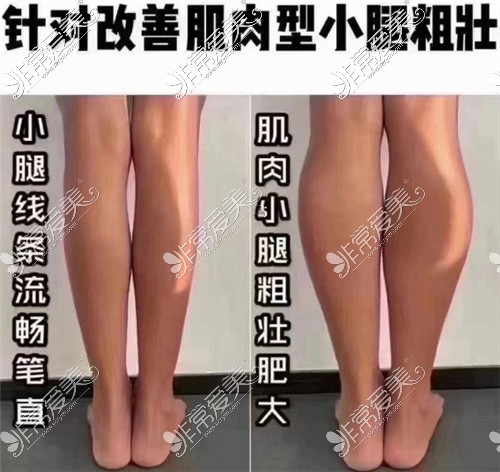 胖腿和瘦腿对比照片图片