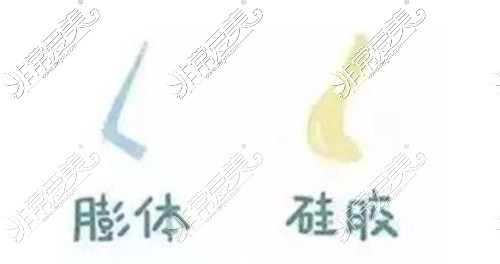 济南膨体假体隆鼻手术哪家医院好?假体和膨体有什么不同