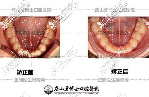 唐山牙博士正畸照片