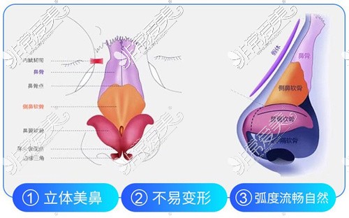 佛山膨体隆鼻哪家整形医院好?佛山膨体隆鼻价格是多少?