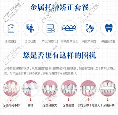 石家庄天伊美正畸优势