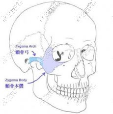 颧骨示意图